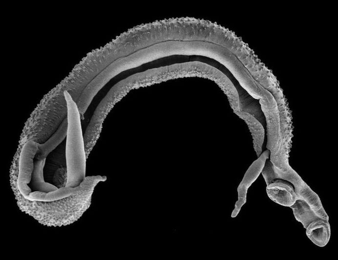 schistosoma z lidského těla