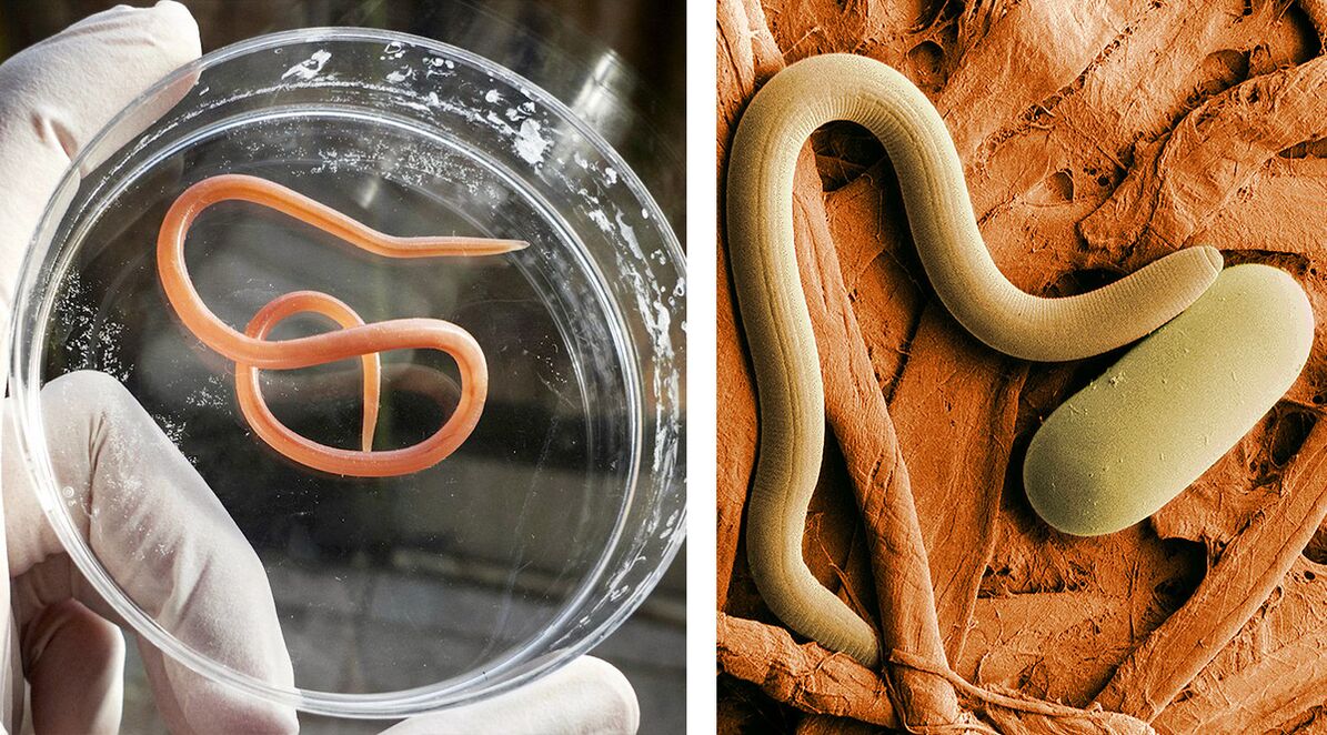 parazitů v lidském těle