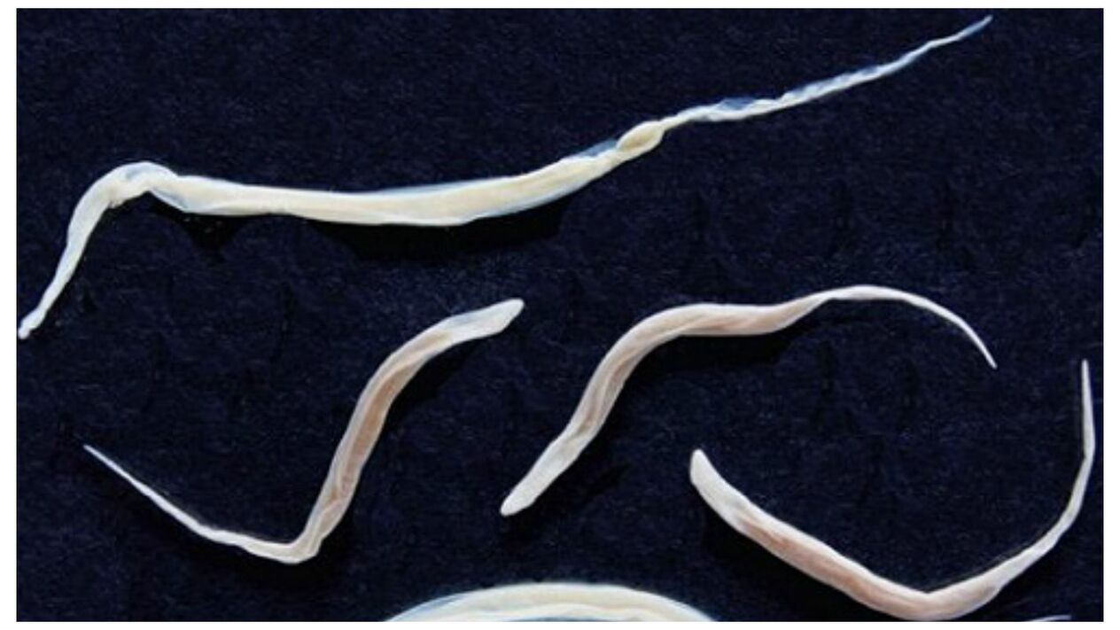 Pinworms jsou běžní parazité patřící do skupiny helmintů.